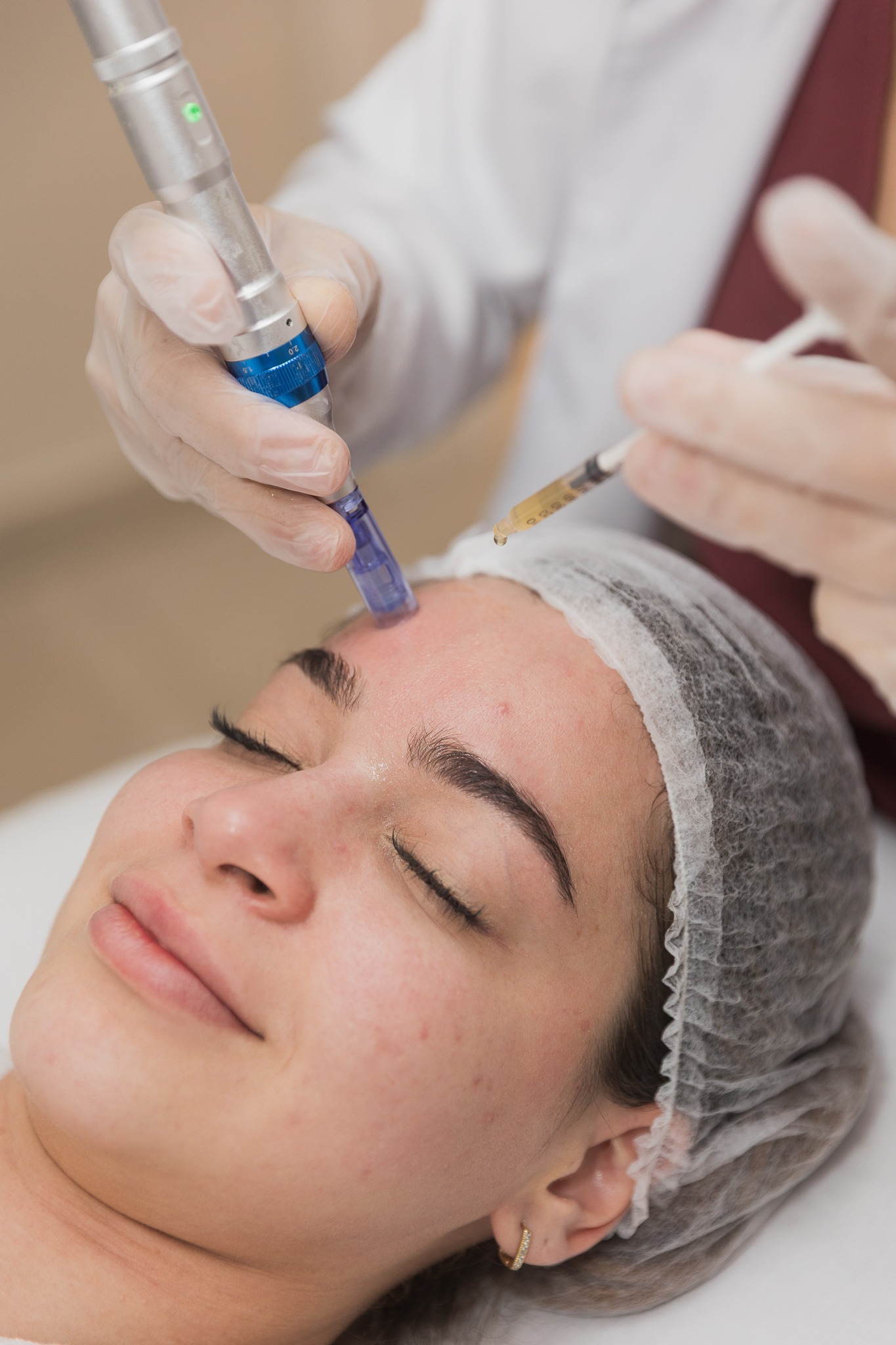 Aplicação facial de PRP na Clínica Gilvania Silva
